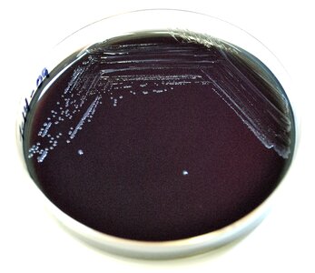 Bacteria gram negative photo