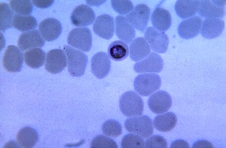 Diversify ebony parasitemia