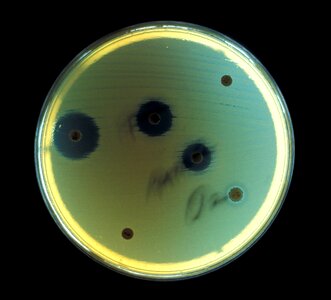 Aerobe bacteria environment photo