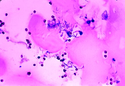 Anthrax autumn bacillus photo