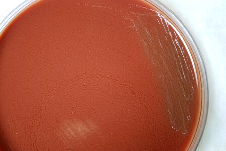 Blood Agar infection petri dish photo