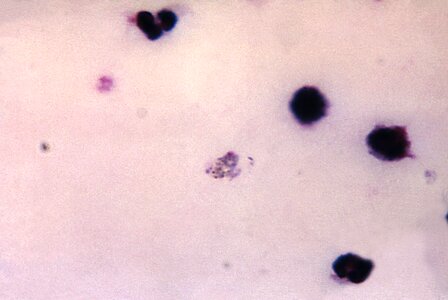 Blood cervical smear plasmodium