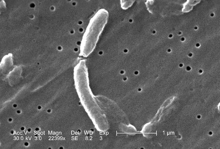 Bacteria vibrio photo