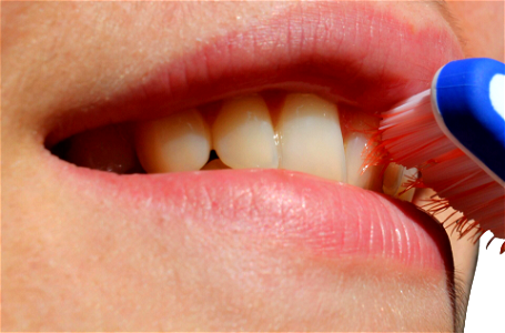 Mouth Oral Dental