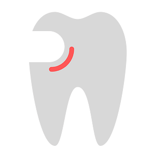 Tooth repair