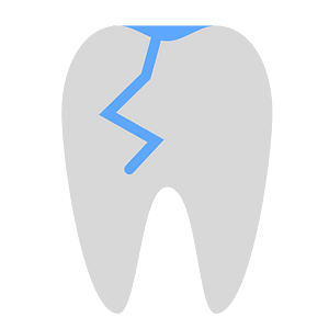 Tooth repair