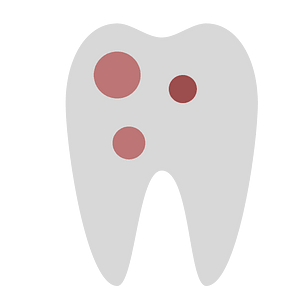 Tooth repair