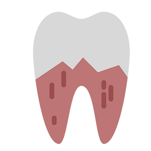 Tooth repair