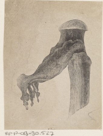 Menselijk bot met een afwijking, RP-P-OB-30.527, Isaac Weissenbruch, between 1836 and 1912