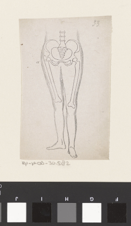 Menselijk bekken met een breuk in het bot, RP-P-OB-30.582, Isaac Weissenbruch, between 1836 and 1912
