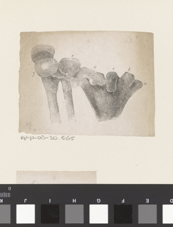 Menselijk bot met een afwijking, RP-P-OB-30.565, Isaac Weissenbruch, between 1836 and 1912