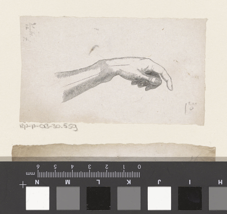 Menselijke pols met een breuk in het bot, RP-P-OB-30.559, Isaac Weissenbruch, between 1836 and 1912