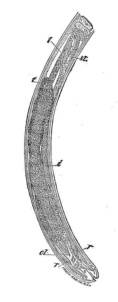 Trichinella spiralis (42)