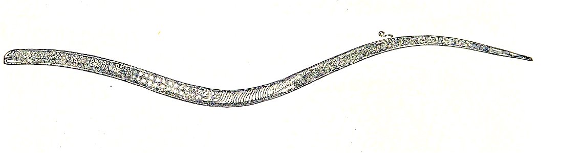 Trichinella spiralis female (12)