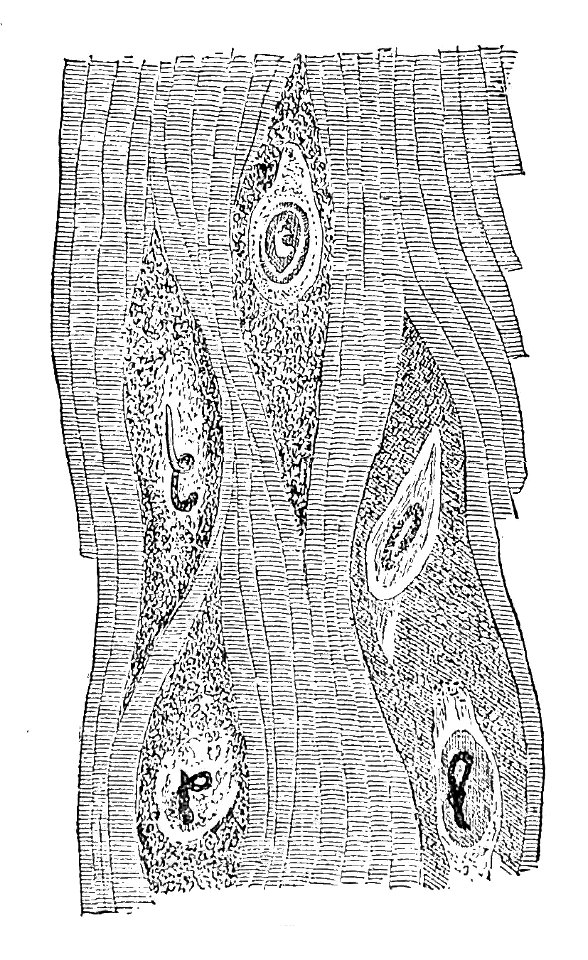 Trichinella spiralis (71)