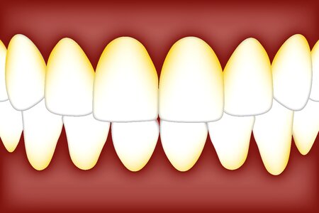 Bacteria mouth tartar. Free illustration for personal and commercial use.