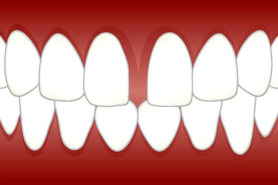 Gap teeth tooth | Creazilla