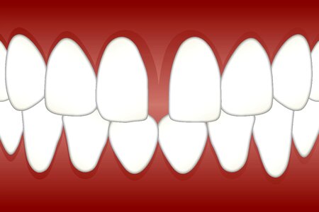 Gap teeth tooth. Free illustration for personal and commercial use.