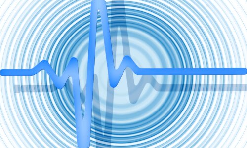 Healthy pulse frequency. Free illustration for personal and commercial use.