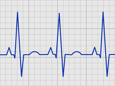 Frequency electrocardiogram medical. Free illustration for personal and commercial use.