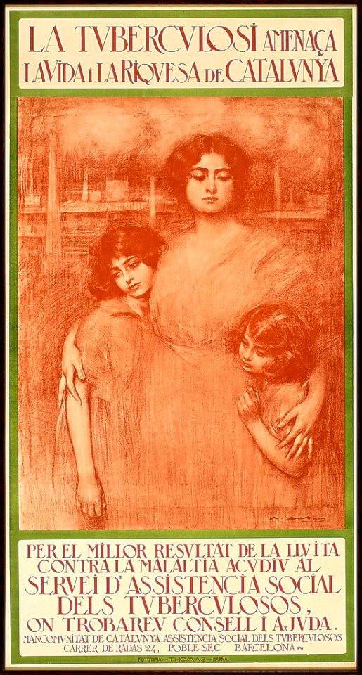 CASAS CARBÓ Ramón.  La tuberculosi amenaça la vida i la riquesa de Catalunya, c. 1910s.