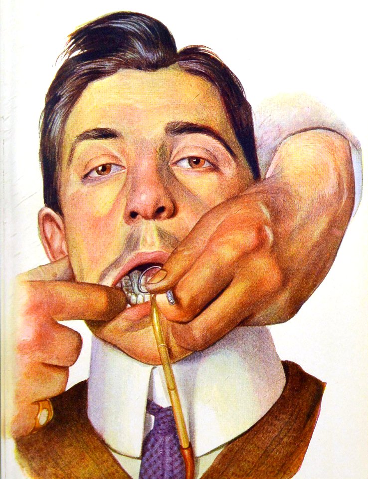 Using the Suction Device