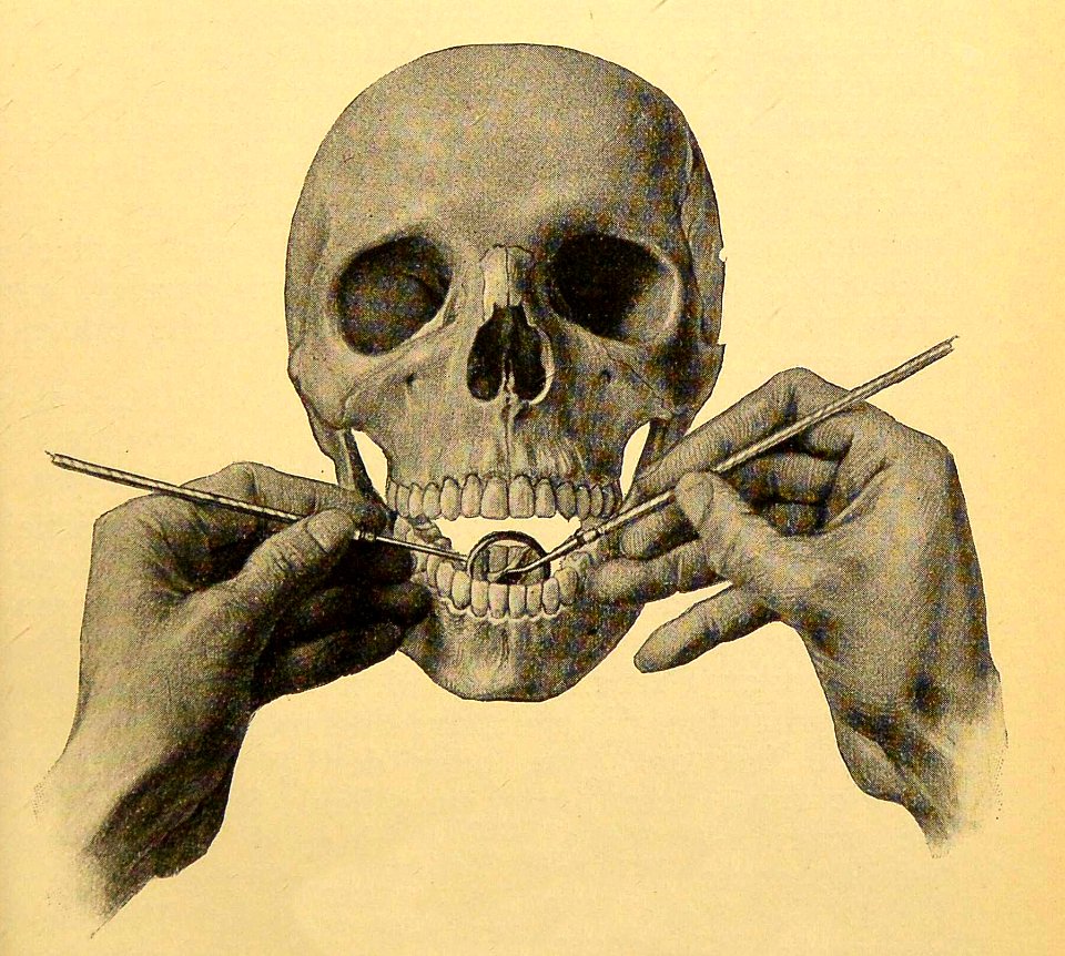 Using the Dental Mirror