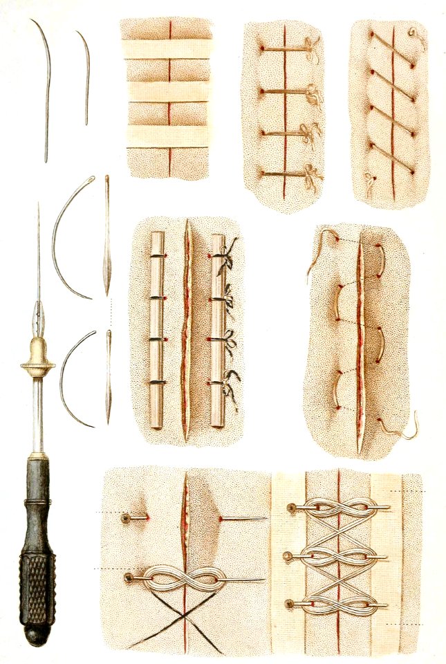 Sutures