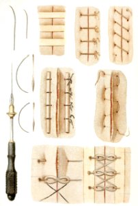 Sutures