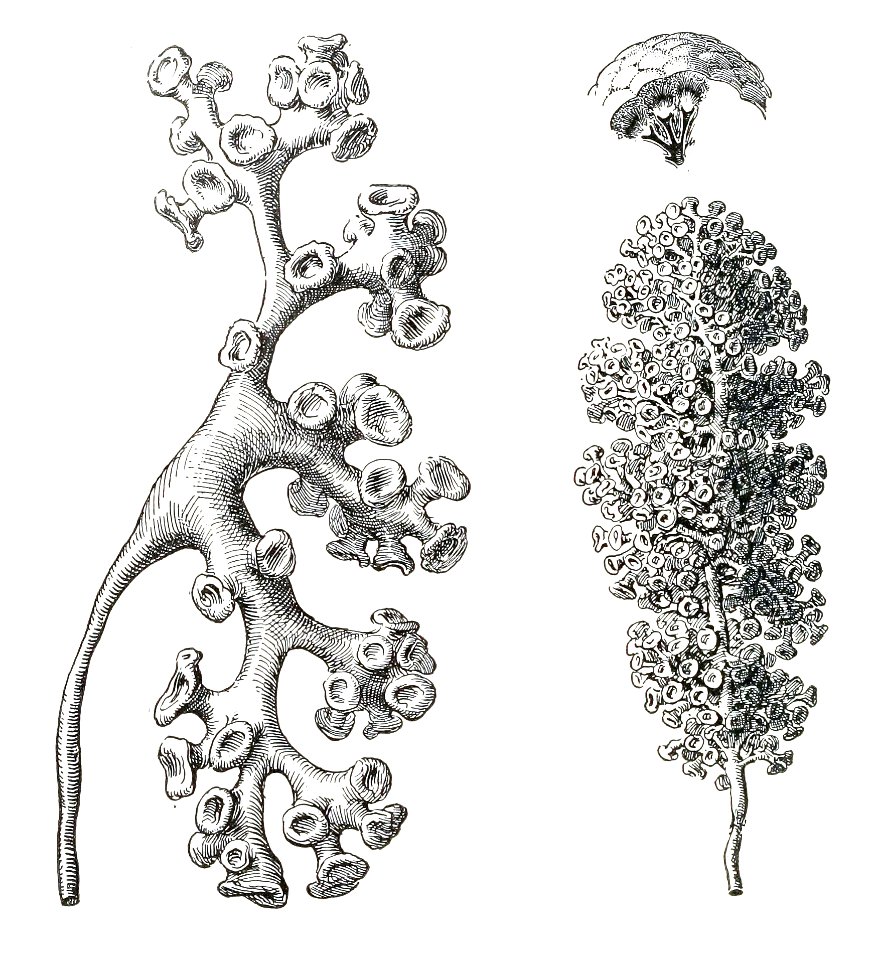 Casts of Renal Pelvis and Calyces