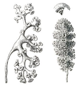 Casts of Renal Pelvis and Calyces