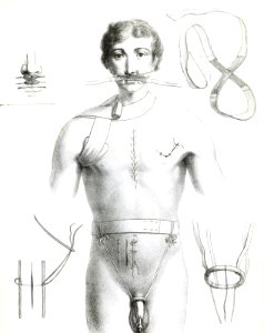 Sutures and Bandages