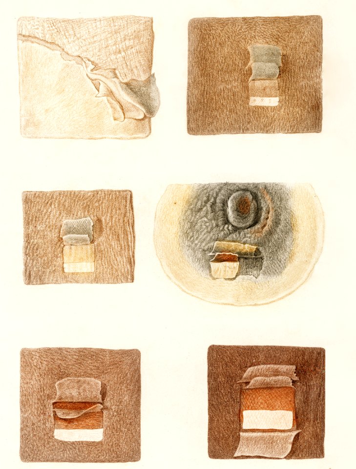 Human skin layers illustrated by Charles Dessalines D' Orbigny (1806-1876). Digitally enhanced from our own 1892 edition of Dictionnaire Universel D'histoire Naturelle.. Free illustration for personal and commercial use.