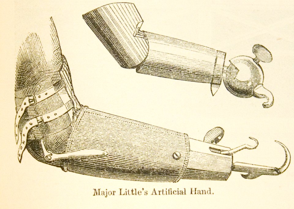 Artificial Hand
