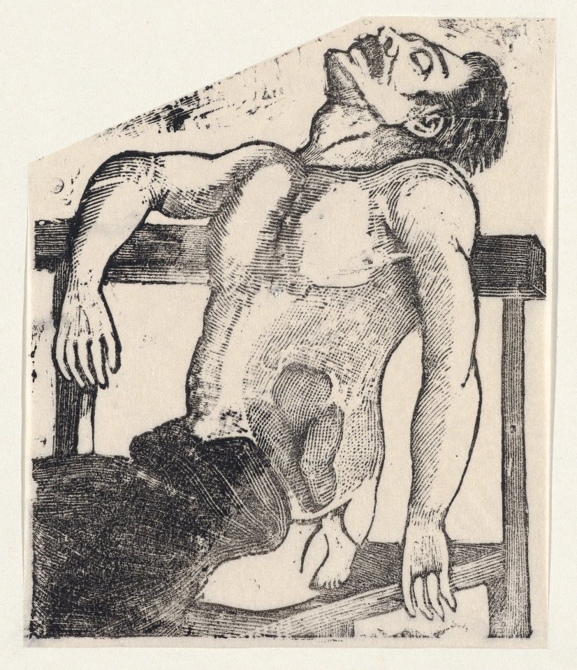 A man with a small foot emerging from his side MET DP869380