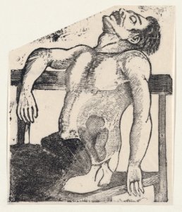 A man with a small foot emerging from his side MET DP869380