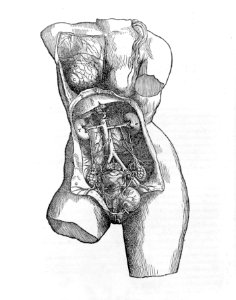 De humani corporis fabrica (Of the Structure of the Human Body) MET MM71296~1