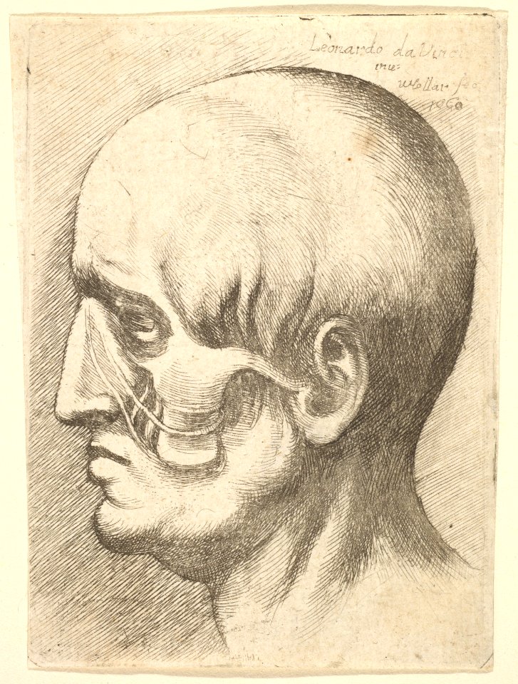 Male head in profile to left with muscles exposed MET DP823724
