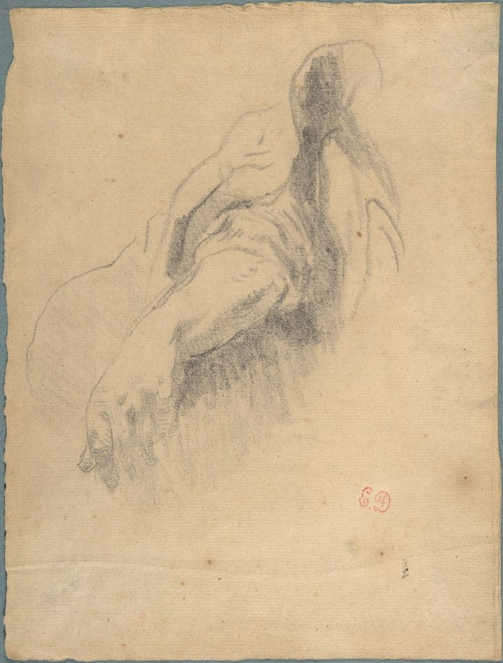 Study of a Left Arm and Hand MET DP805853