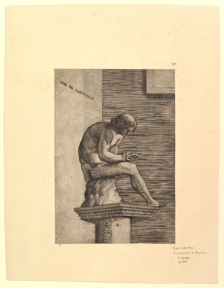 Speculum Romanae Magnificentiae- Man Removing a Thorn from his Foot MET DP820276
