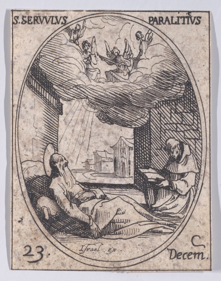 St. Survulus, the paralytic Met DP891270