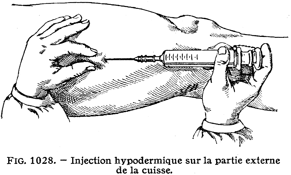 injection-3
