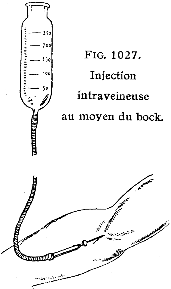injection-2