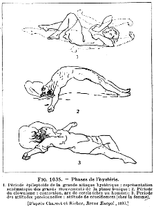 histérie-1
