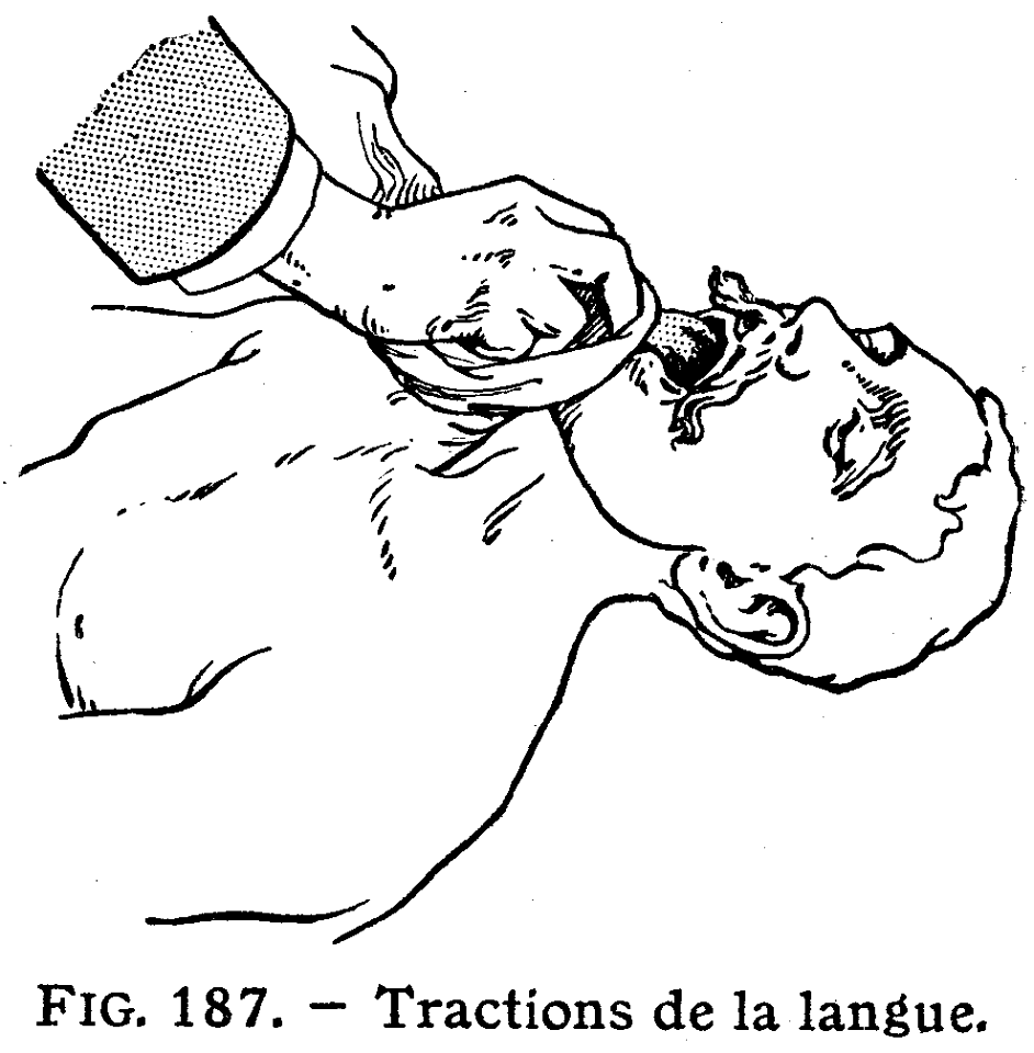 traction langue