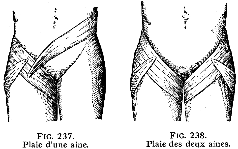 bandage-3