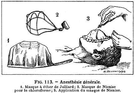 anesthésie