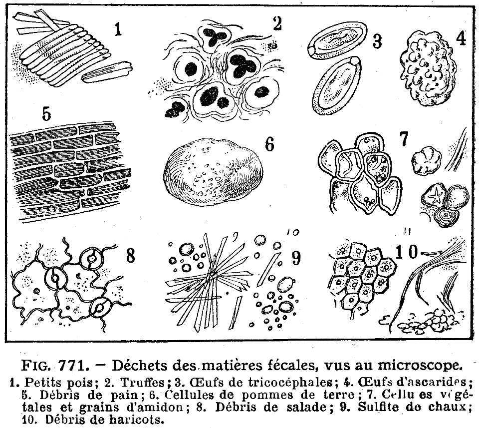 déchets