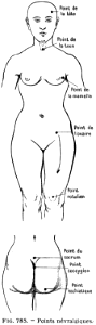 femme-points névralgiques