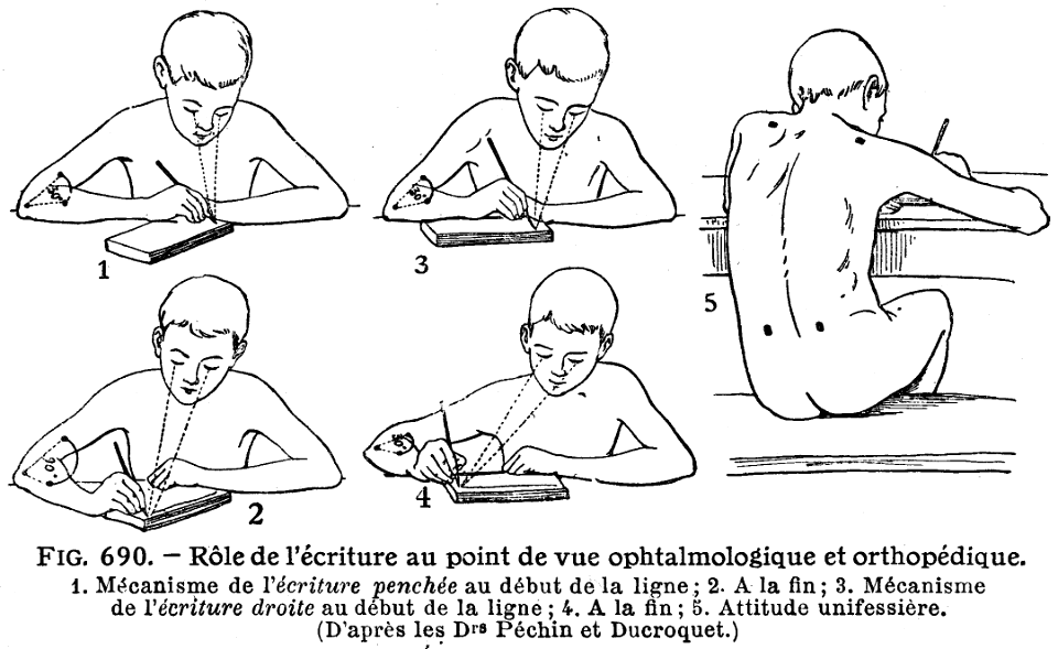 écriture